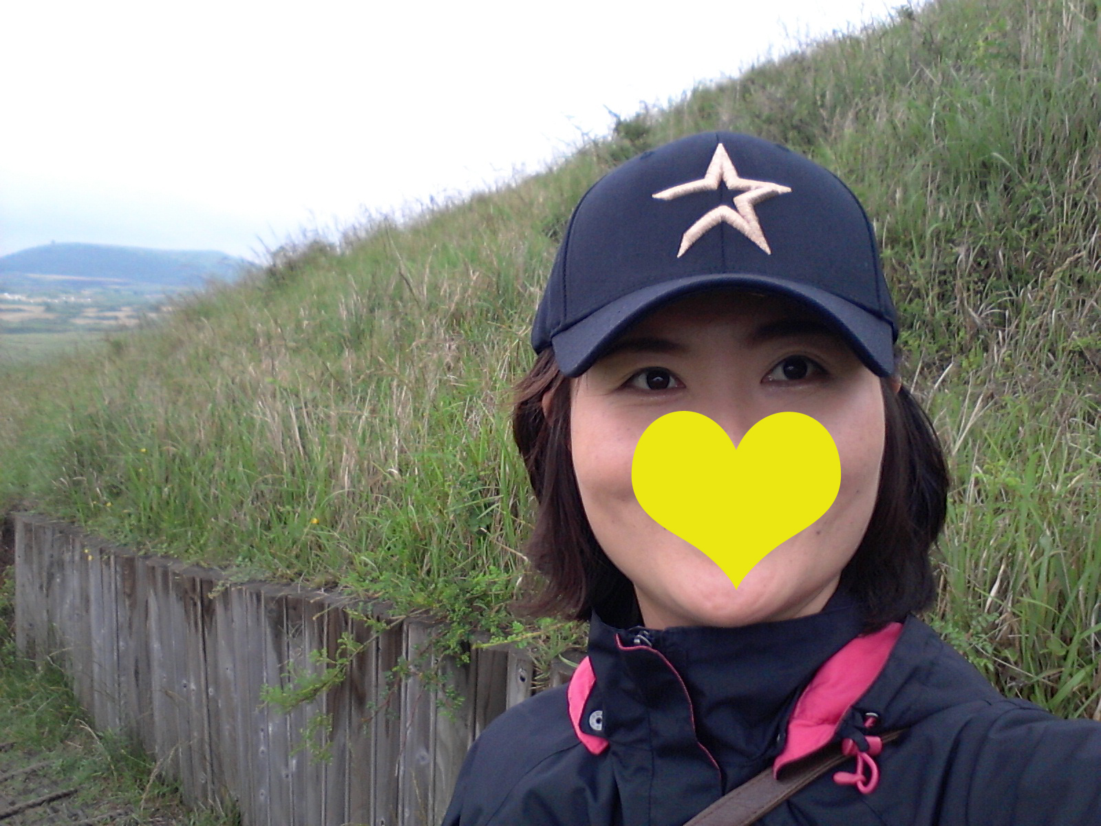 나를 한층 돋보이게 한 수술